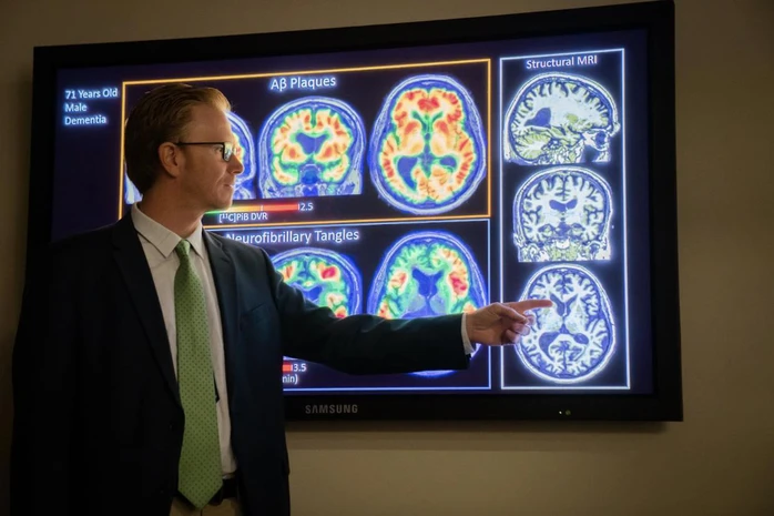 Bước tiến mới về điều trị bệnh Alzheimer