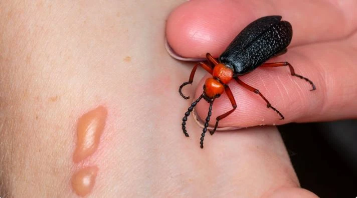 Nguy kịch tính mạng vì ăn sâu ban miêu